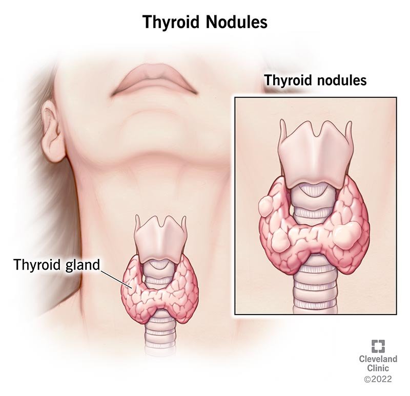 Thyroid Profile