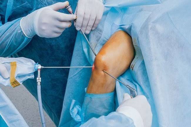 Joint Replacement Surgery (Knee, Hip, Shoulder)