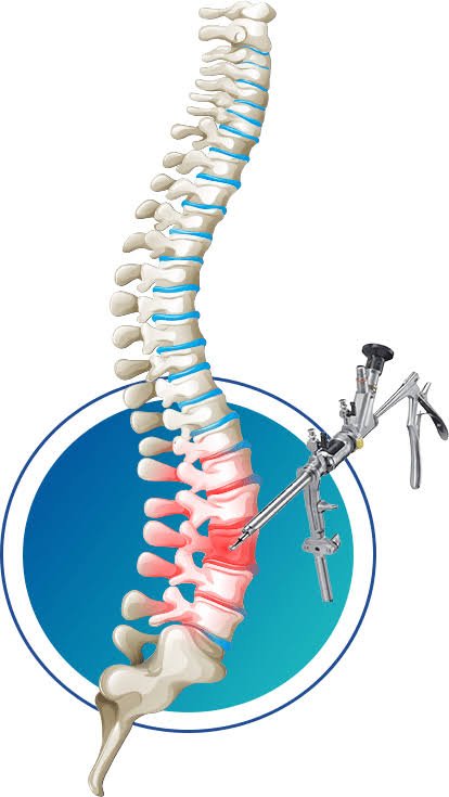 Spine Treatment & Surgery